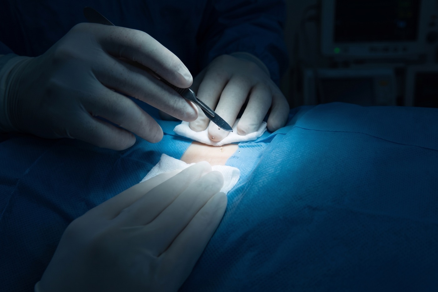 A surgeon's gloved hands making an incision in the operating room